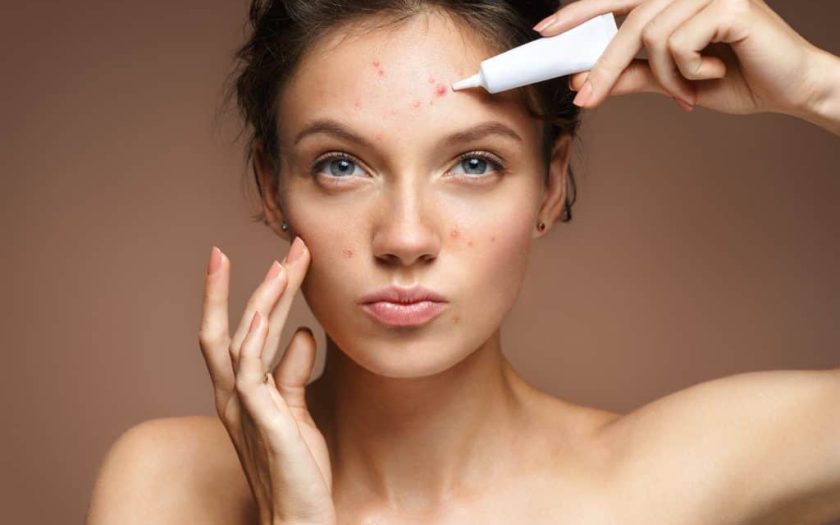 Acne on the face - why they occur and how to treat them