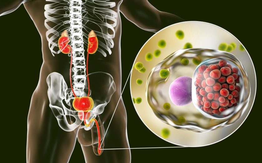 Chlamydial infection - what is chlamydia and how it is treated