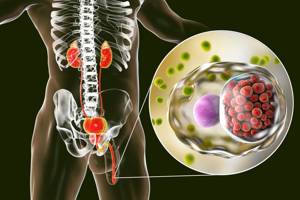 Chlamydial infection - what is chlamydia and how it is treated Chlamydial infection - what is chlamydia and how it is treated