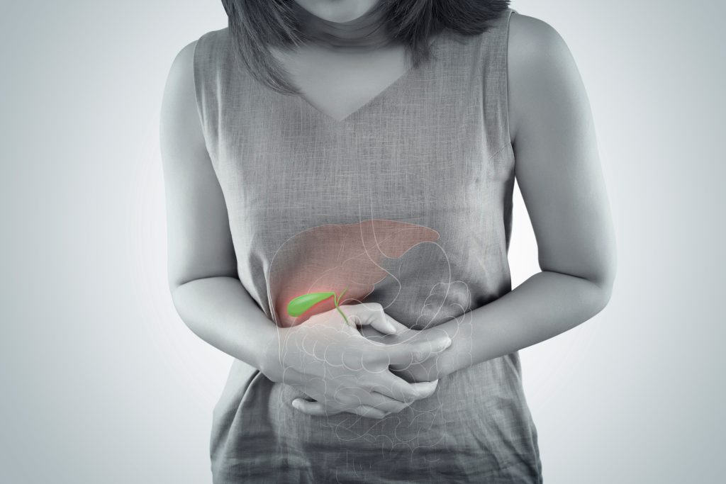Gallstones - symptoms, causes and treatment Gallstones - symptoms, causes and treatment