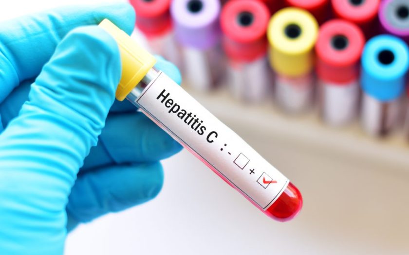 Hepatitis C - cause, symptoms and treatment