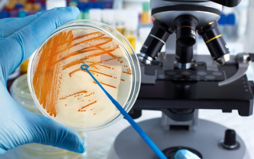 How bacteria are formed in the urine