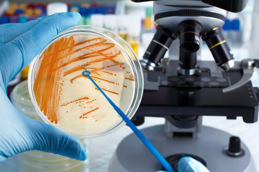 How bacteria enter urinary tract?