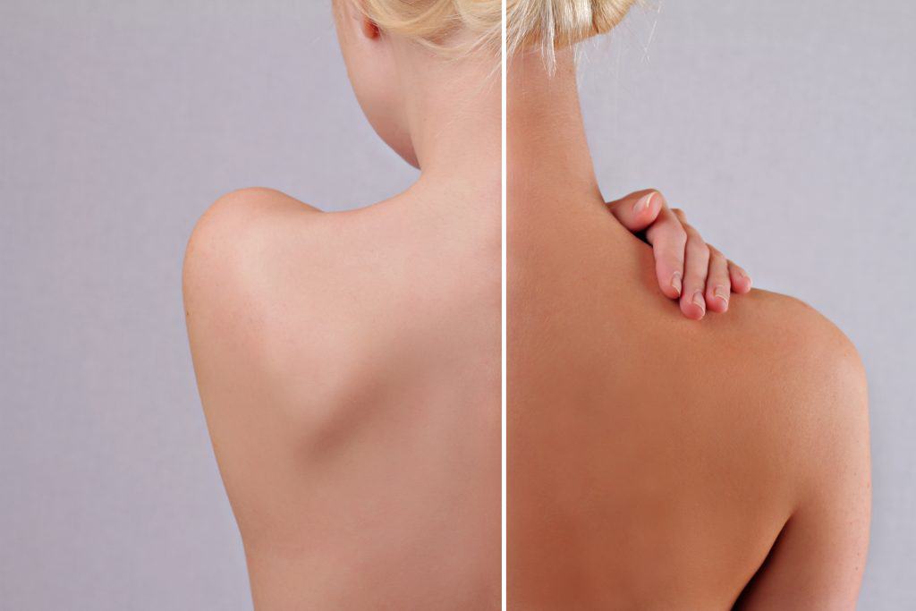 How self-tanning cream affects the skin How self-tanning cream affects the skin Tips