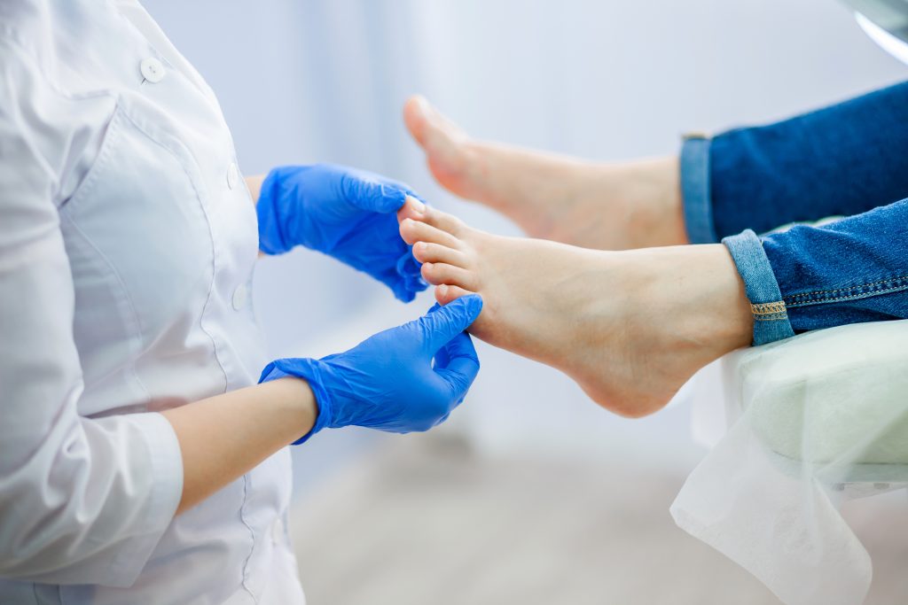 How to get rid of fungus on the feet How to get rid of fungus on the feet