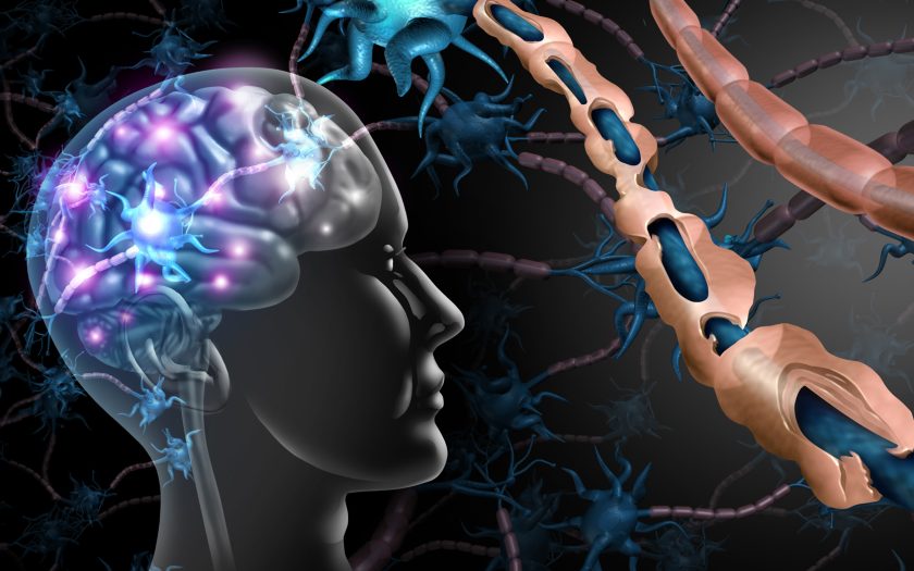 multiple sclerosis