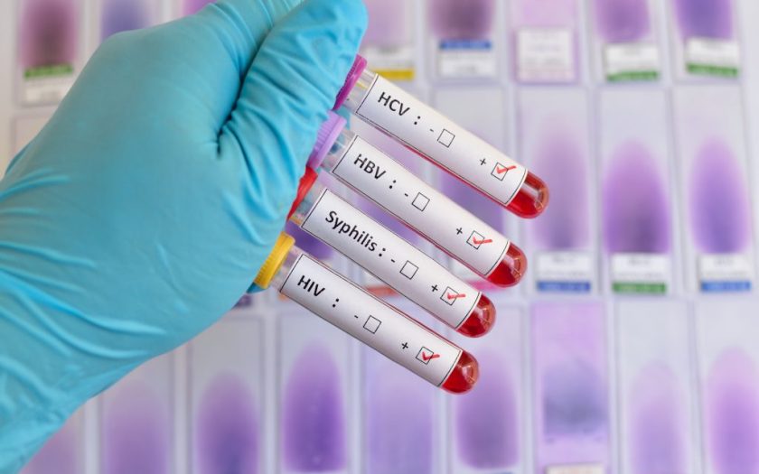 Sexually transmitted diseases - symptoms, treatment and protection