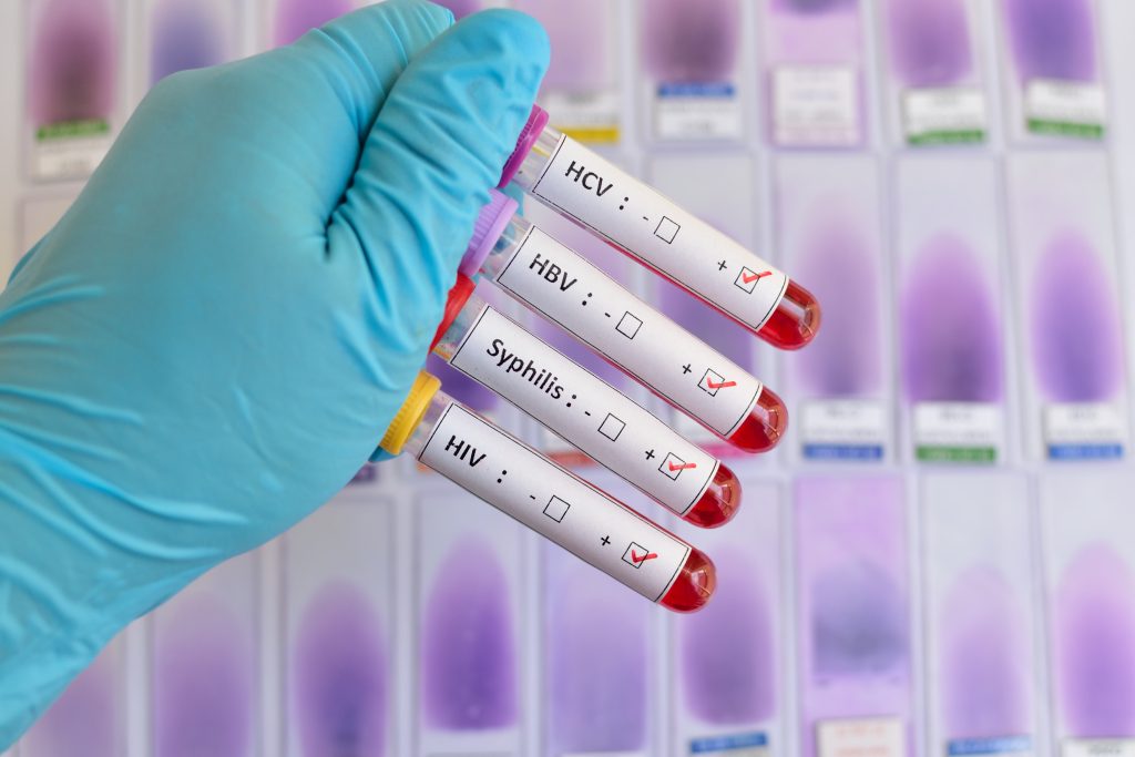 Sexually transmitted diseases - symptoms, treatment and protection