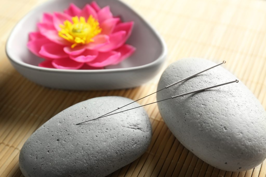 What is acupuncture and how is it performed